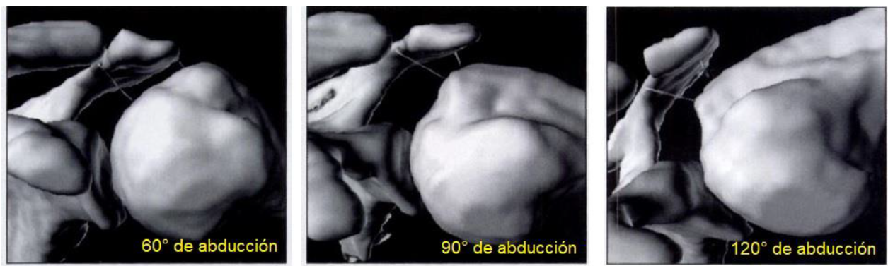 angulos de abducción del hombro